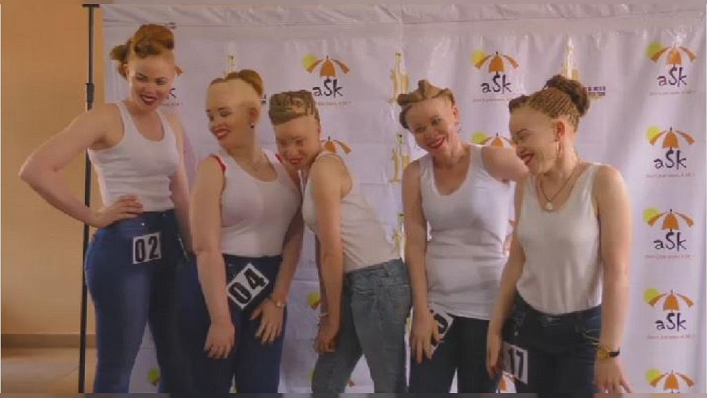 Ouganda dévoile ses reines de beauté albinos