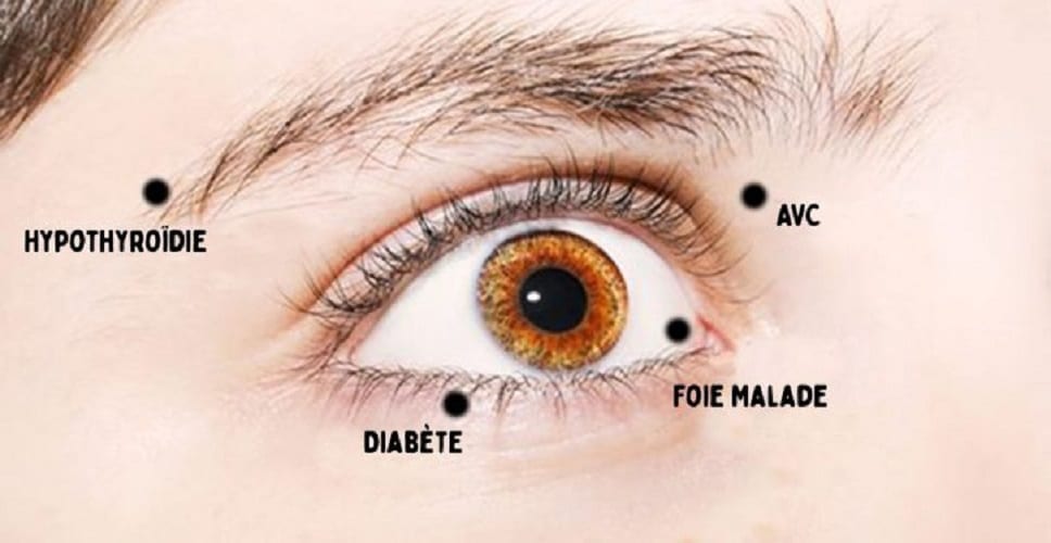 8-choses-que-vos-yeux-essaient-de-vous-dire-a-propos-de-votre-sante-725x375 8 choses que vos yeux essaient de vous dire à propos de votre santé