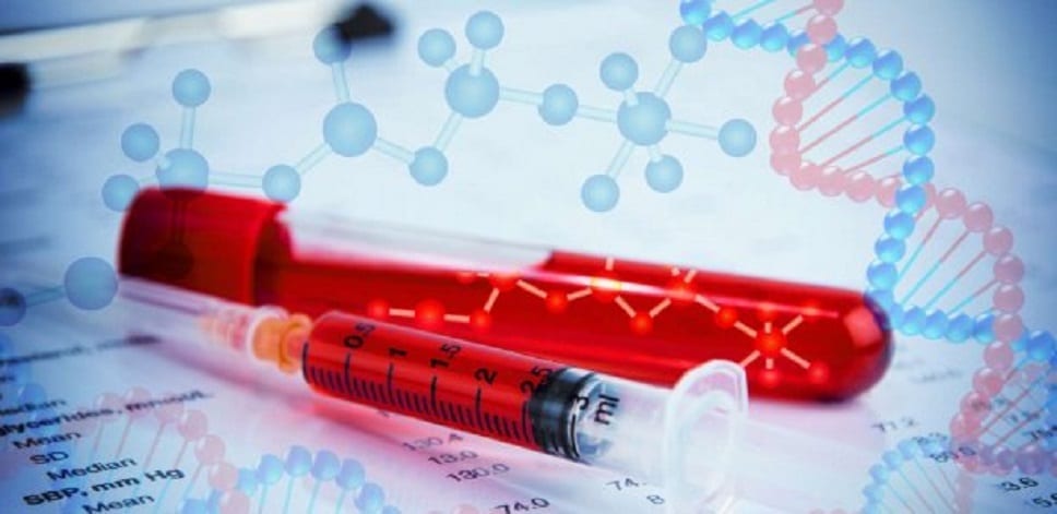 Hémophilie 239 cas diagnostiqués au Sénégal Hémophilie 239 cas diagnostiqués au Sénégal