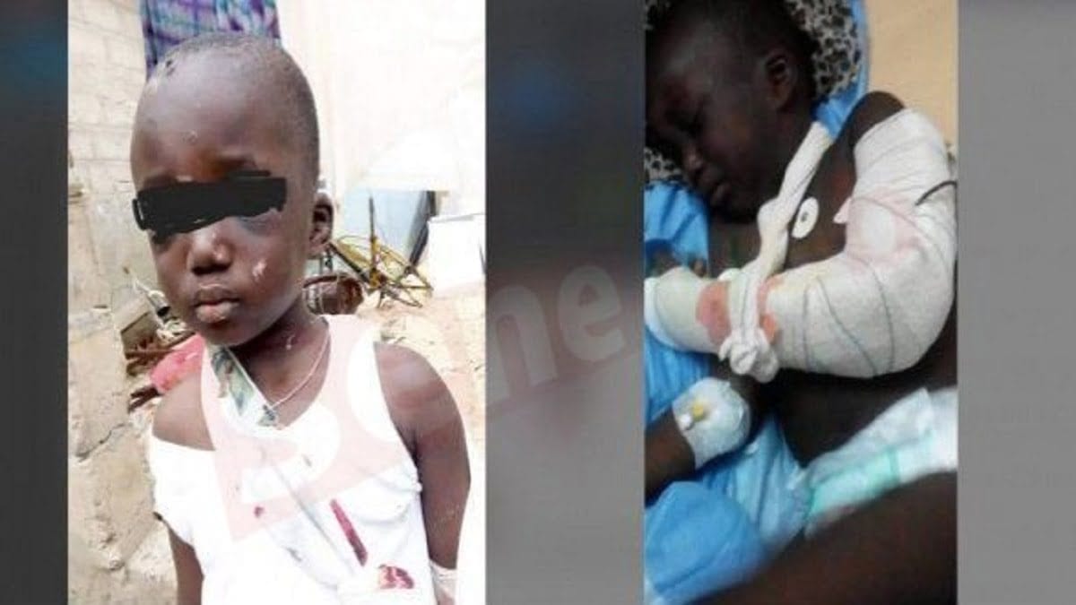 Enfant torturé à Mbour Les révélations affligeantes de sa maman Enfant torturé à Mbour : Les révélations affligeantes de sa maman