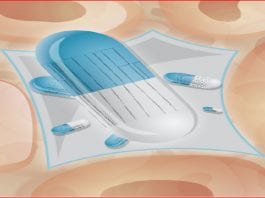 cancer de la prostate - Capture