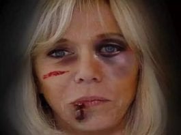 Brigitte Macron un oeil au beurre noir : les explications sur l'image choc
