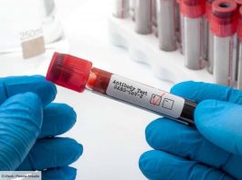 Covid-19 et immunité combien de temps les anticorps peuvent-ils durer après une infection