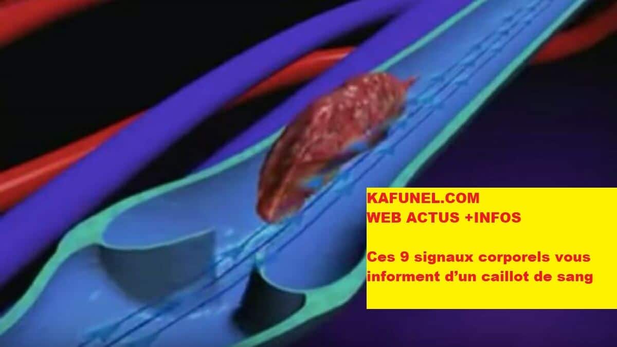 Ces 9 signaux corporels vous informent d’un caillot de sang Ces 9 signaux corporels vous informent d’un caillot de sang