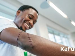 10 Conseils Essentiels pour Soigner vos Points de Suture (2)